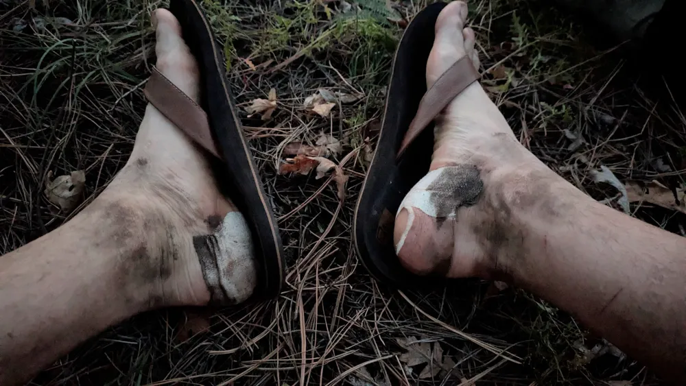 Dirty feet